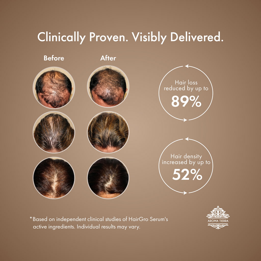 HairGro Hair Growth Serum for Men (with 9 Clinically Proven Bio-Actives)
