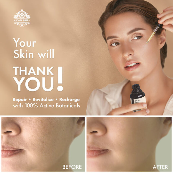 Face Oil Set - Rosehip, Prickly Pear, Frankincense Essential Oil