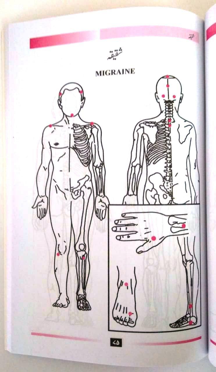 Al Hijama - Cupping Healing The Sunnah Way by Dr. Amjad Ahsan Ali