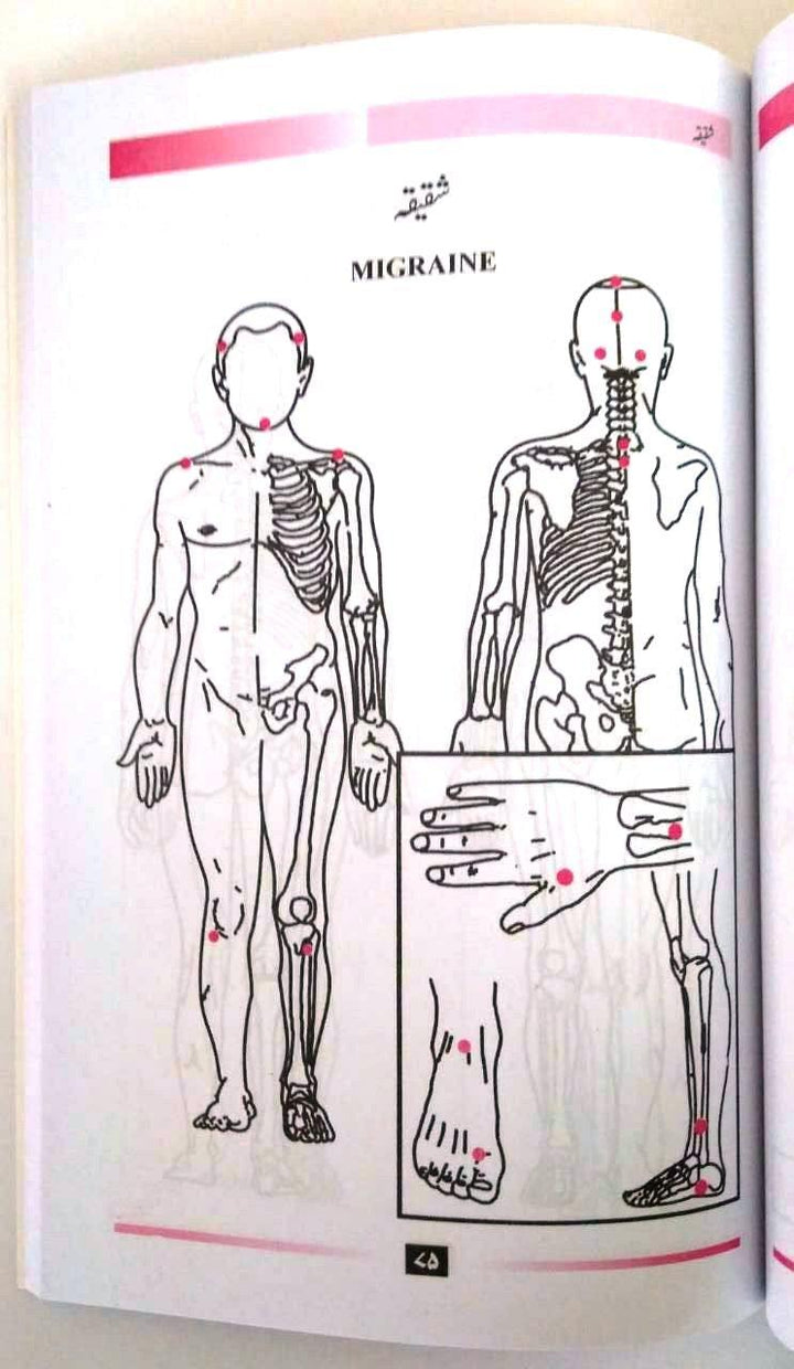 Al Hijama - Cupping Healing The Sunnah Way by Dr. Amjad Ahsan Ali